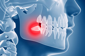 chirurgia orale 1