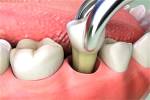 chirurgia orale 2