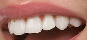 estetica dentale 2