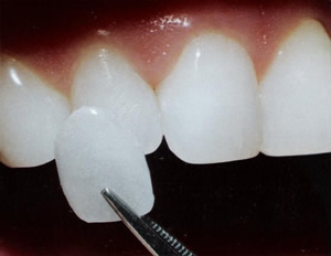 estetica dentale 3